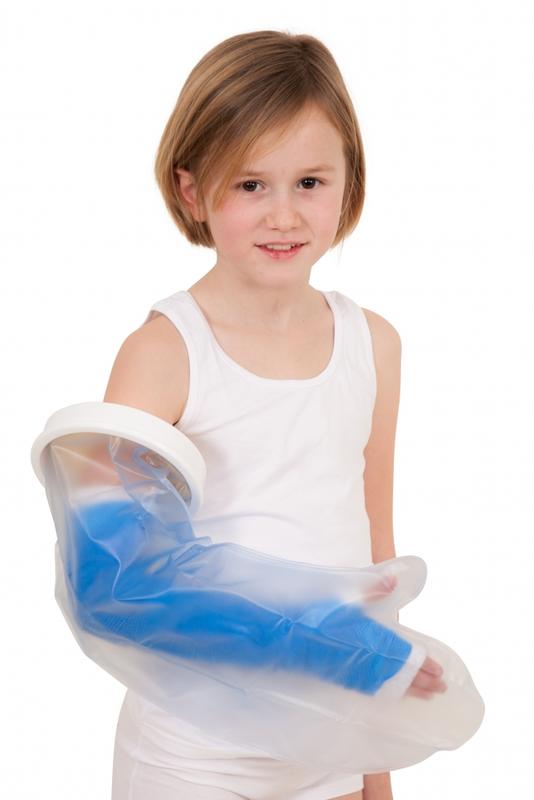 Able 2 Gipshoes hele arm kind 1 Stuks
